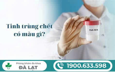 Hình ảnh minh họa